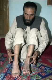 New Case of Prisoner Abuse in US Custody in Afghanistan